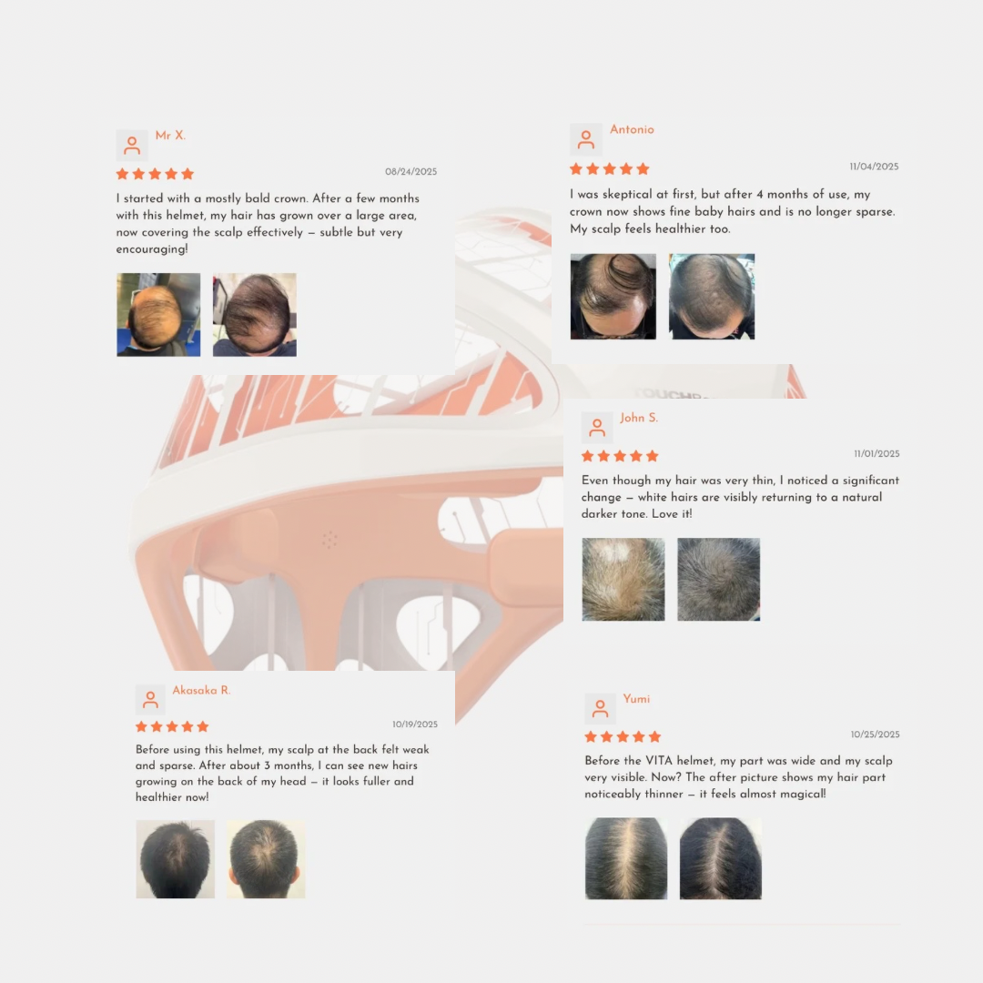 VITA grafen-hjelm til revitalisering af hovedbunden | Avanceret fjerninfrarød hovedbundsbehandling . Aktiverer hårsækkene og stimulerer væksten