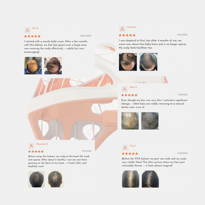 VITA grafen-hjelm til revitalisering af hovedbunden | Avanceret fjerninfrarød hovedbundsbehandling . Aktiverer hårsækkene og stimulerer væksten