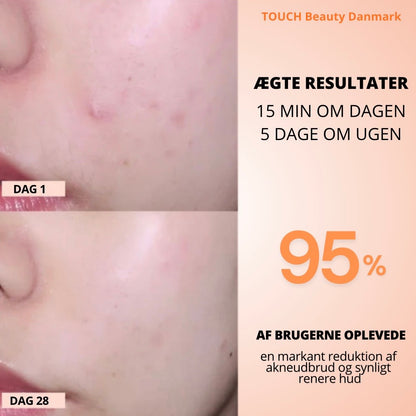 TOUCHBeauty GLAM LED Light Therapy Mask | Avanceret hudpleje mod rynker, akne og pigmentering .