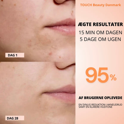 TOUCHBeauty GLAM LED Light Therapy Mask | Avanceret hudpleje mod rynker, akne og pigmentering .